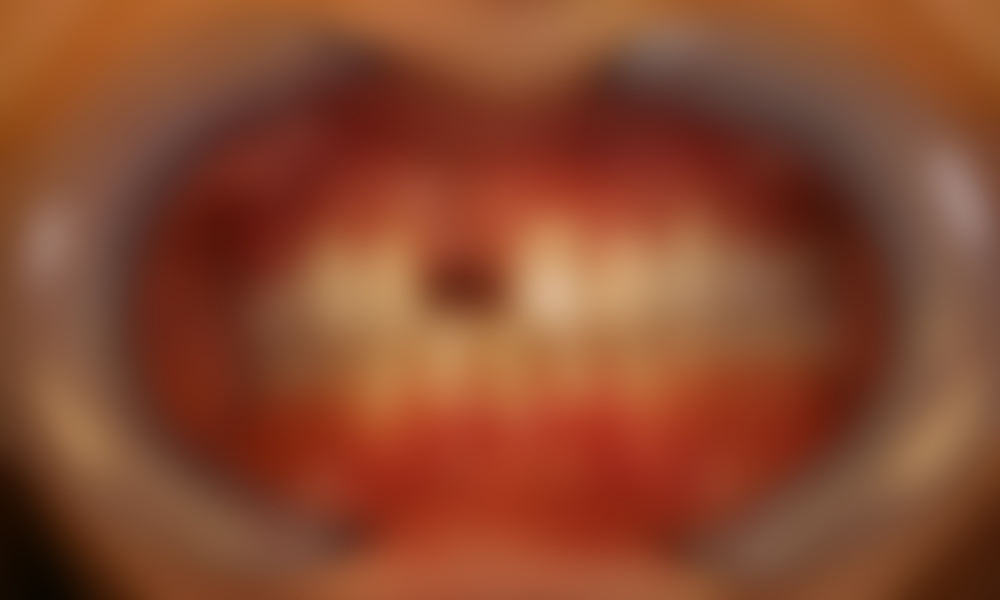 Case hope experience 2