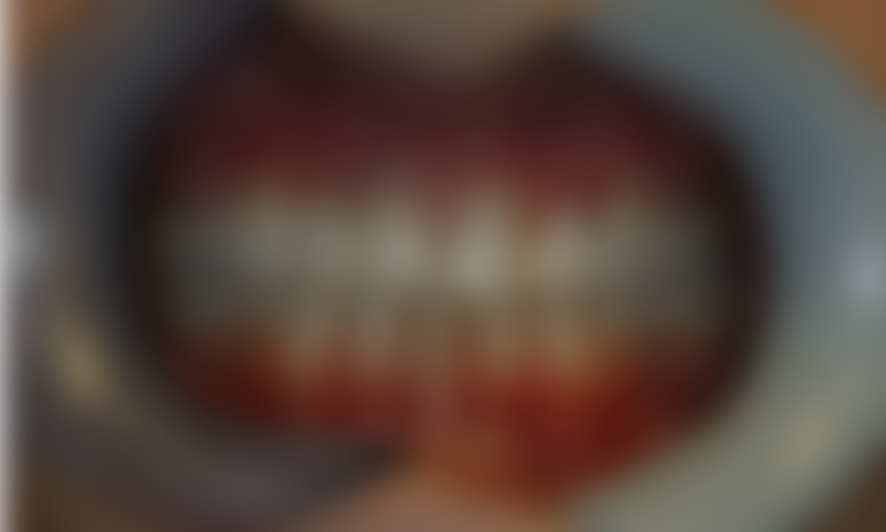 Case hope experience 3