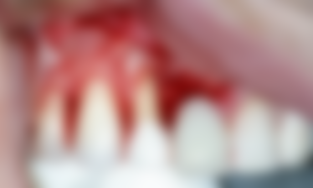 Case hope experience 4