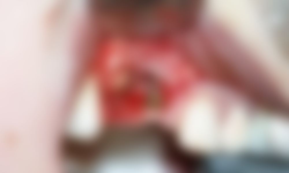 Case hope experience 5