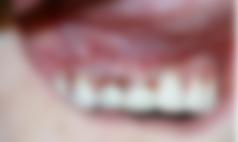 Case hope experience 6