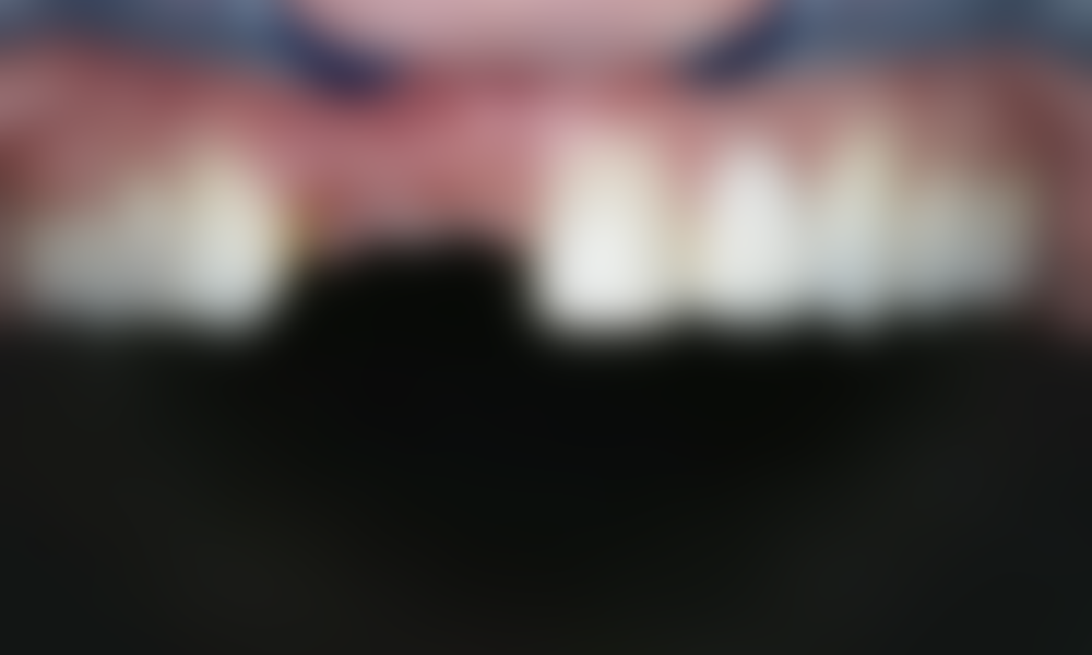 Case hope experience 7