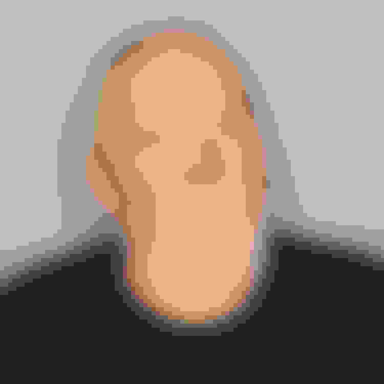 Jim zygomatic full arch facewall