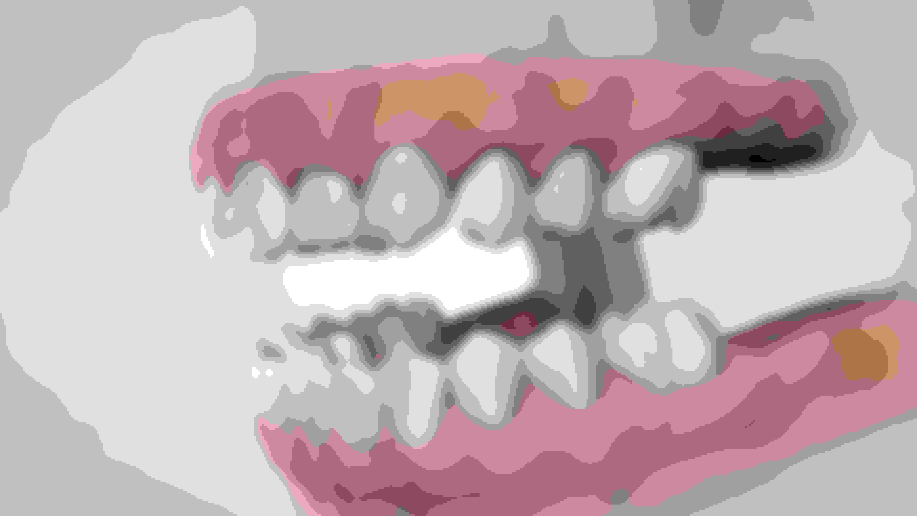 Instruction  full arch