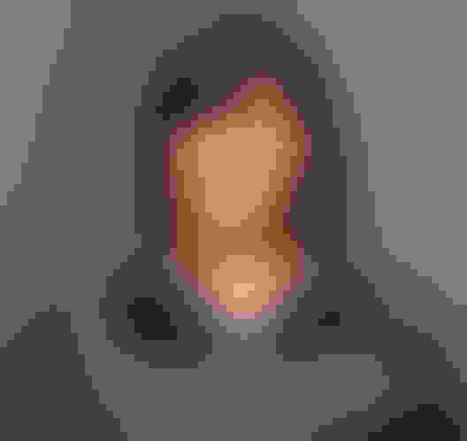 About staff jenn surgical assistant