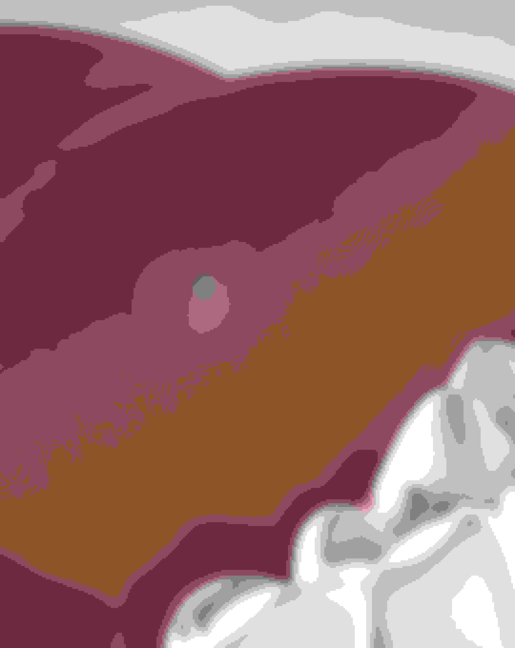 Oral Pathology at Oral Surgery Group New Brunswick, East Brunswick