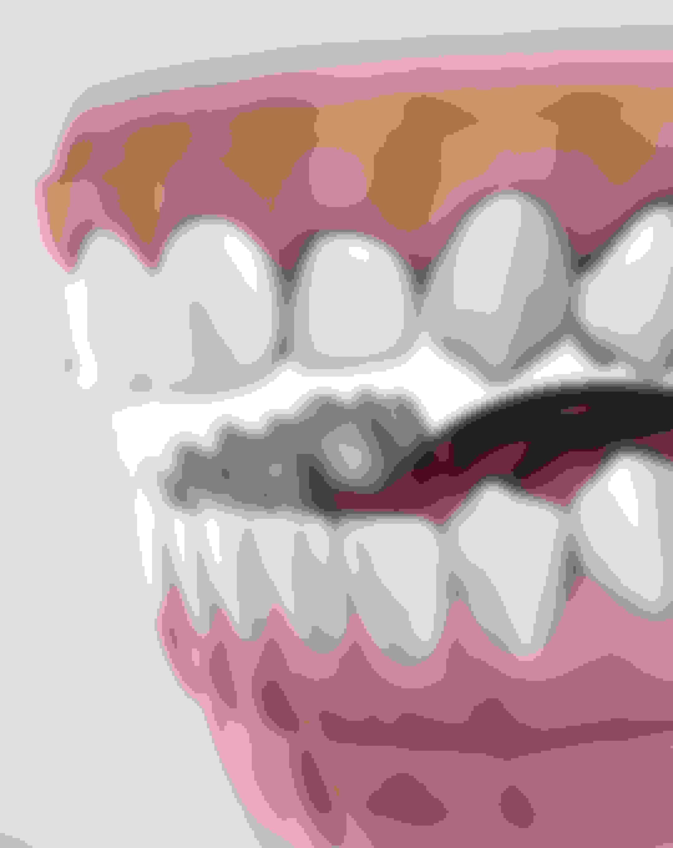 PreProsthetic Surgery at Oral Surgery Group New Brunswick, East