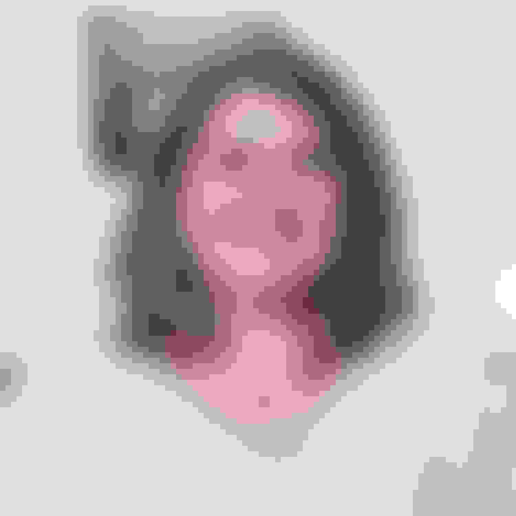 Testimonial facewall amanda botox