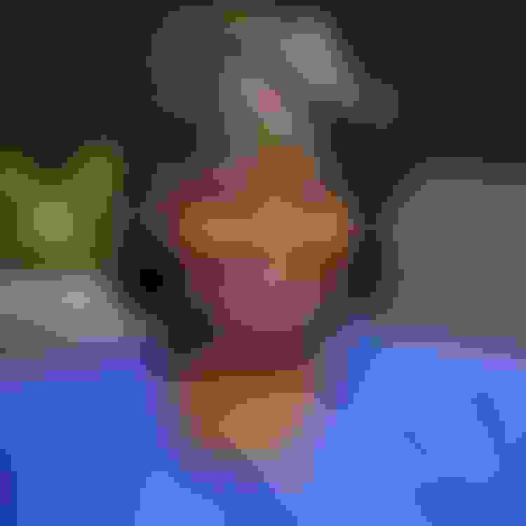 Vesta dental implant  facewall