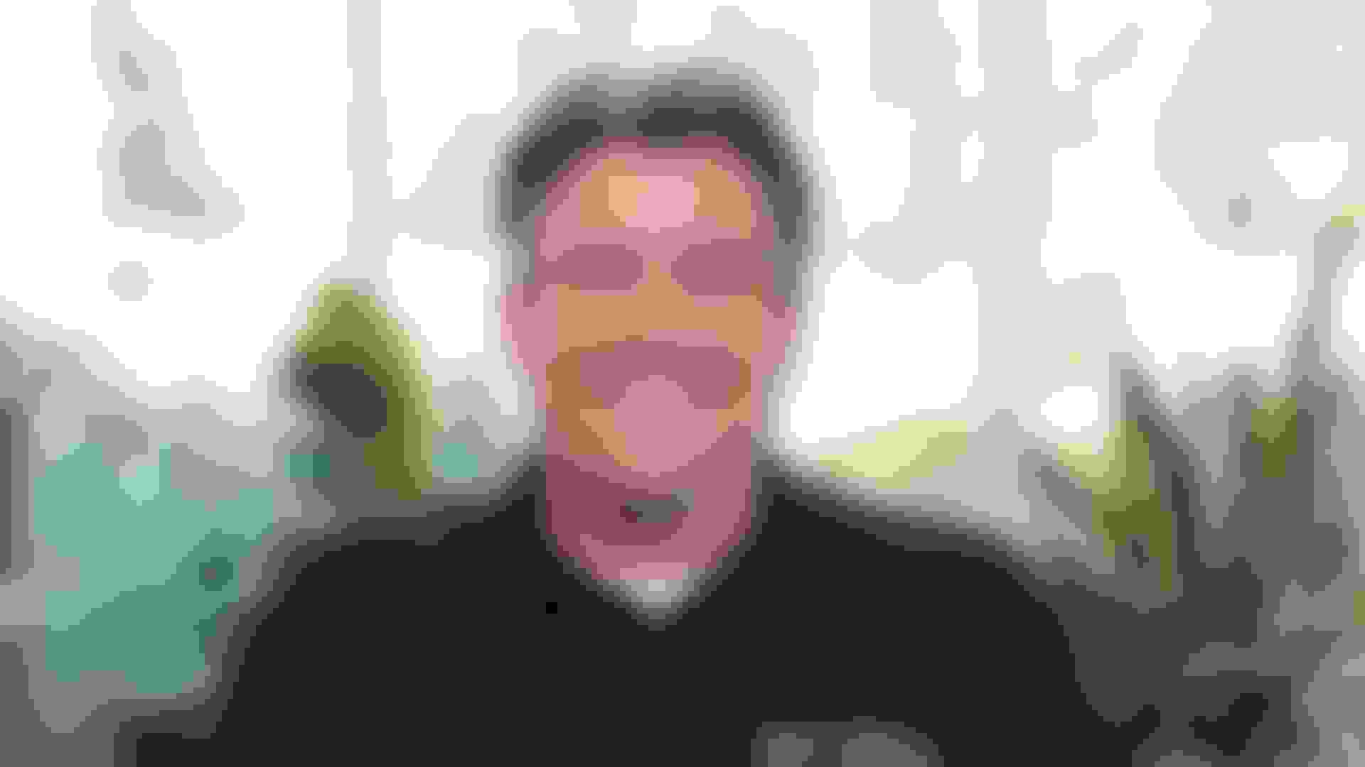 Mark wisdom teeth removal  desktop