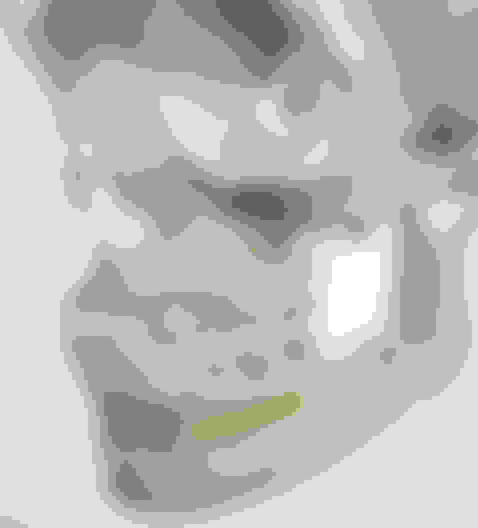 query  facial trauma