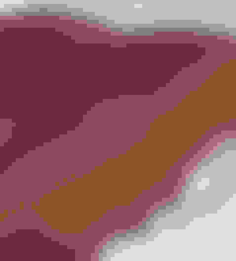 query  oral pathology