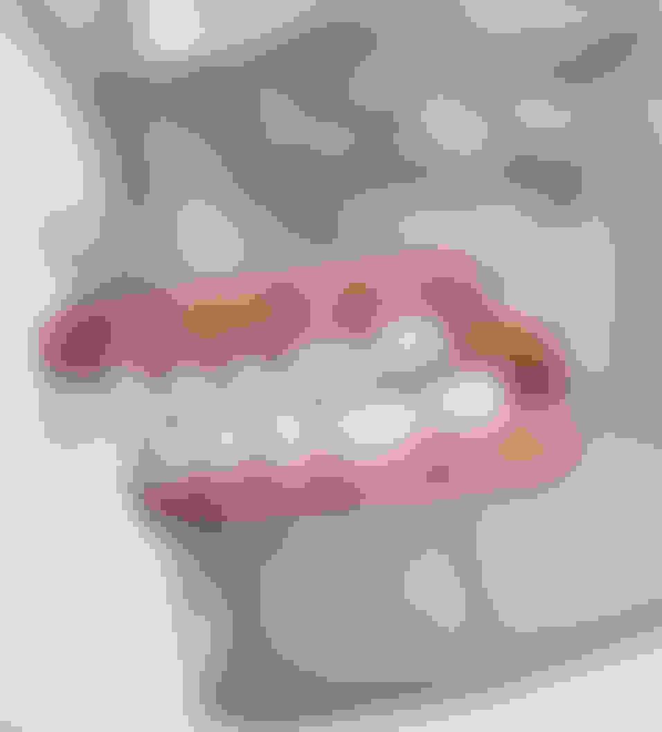 query  orthognathic jaw surgery