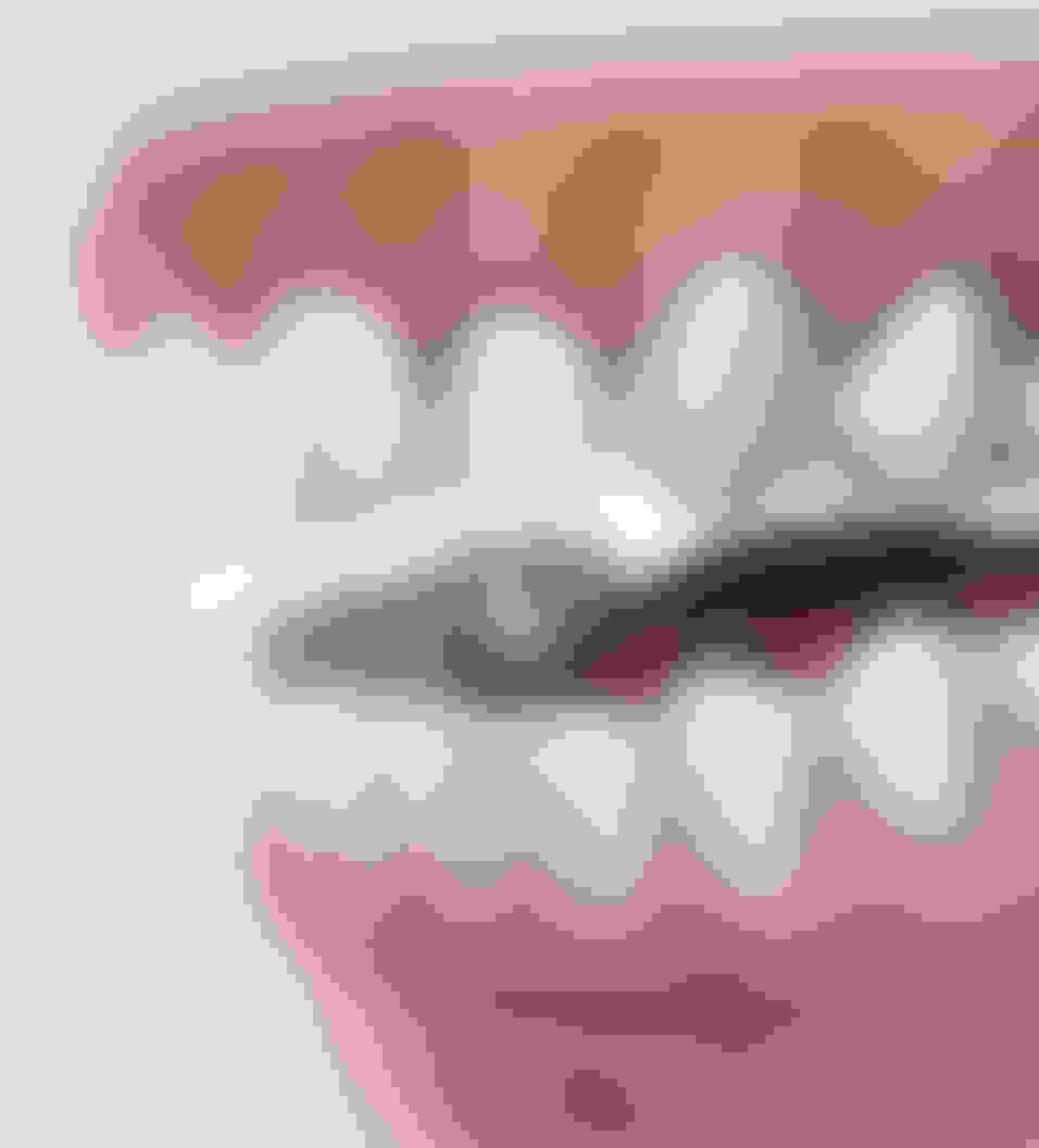 query  pre prosthetic surgery