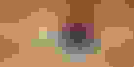 Implant surgery case 0 before