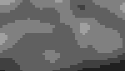 Implant surgery case 1 after 3