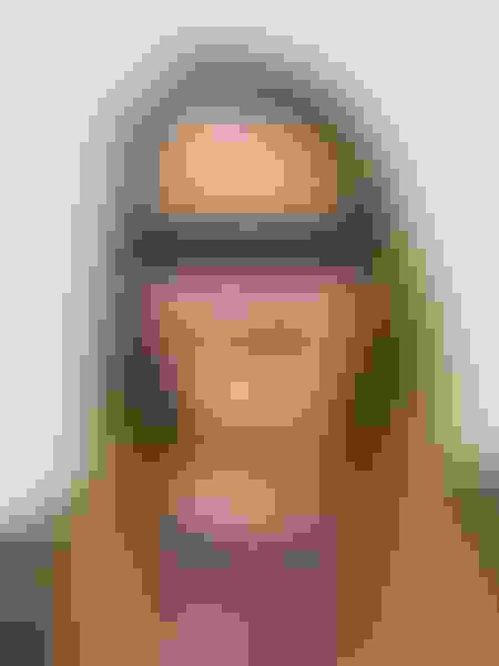 Implant surgery case 1 before 1