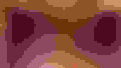 Implant surgery case 1 before 2