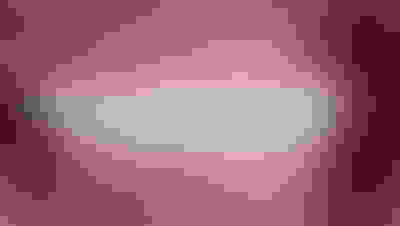 Implant surgery case 2 after 2