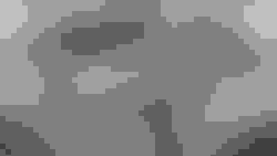 Implant surgery case 2 after 3