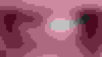 Implant surgery case 2 before 2