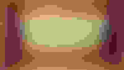 Implant surgery case 3 after 2