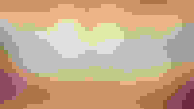 Implant surgery case 4 after 2