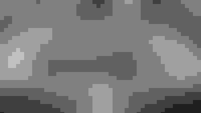 Implant surgery case 4 after 3