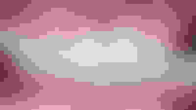 Implant surgery case 4 before 2