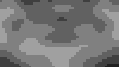 Implant surgery case 5 after 3