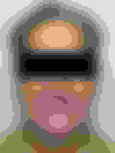 Implant surgery case 5 before 1