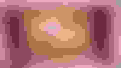 Implant surgery case 5 before 2