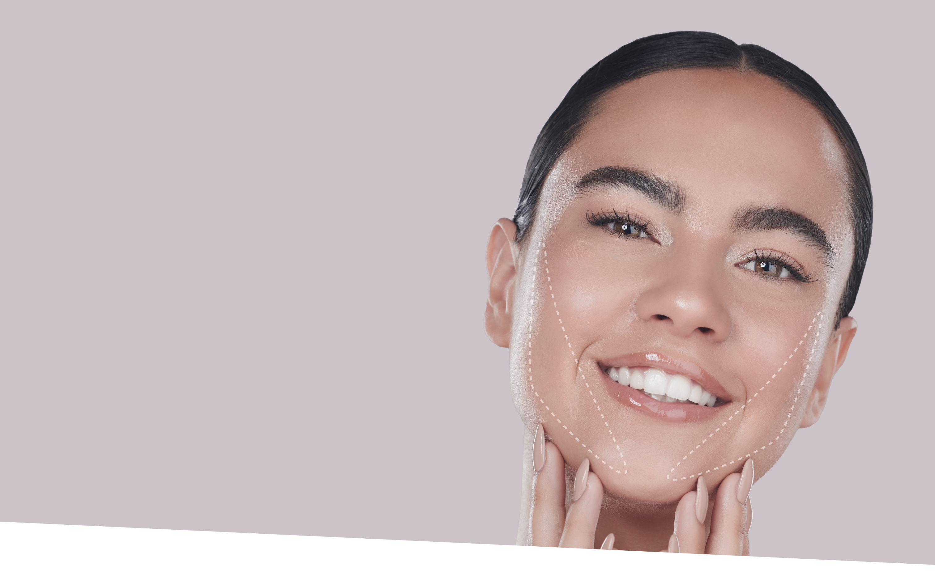 77 buccal fat removal