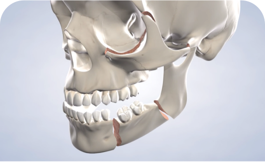 Facial trauma procedure query page