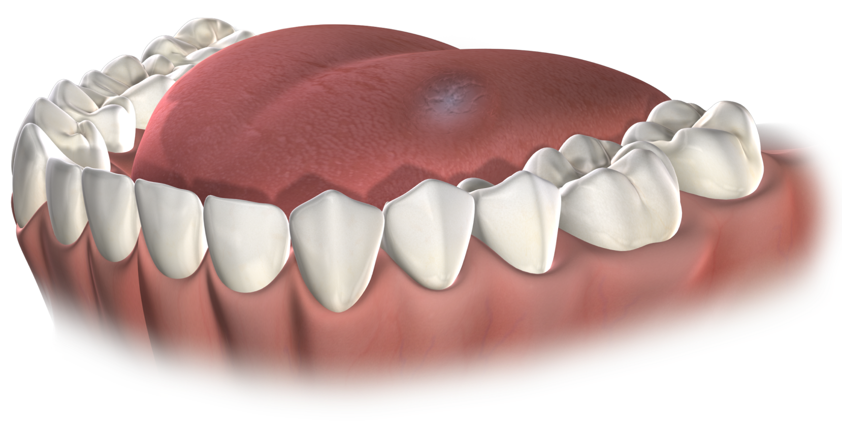 Isolated  oral pathology