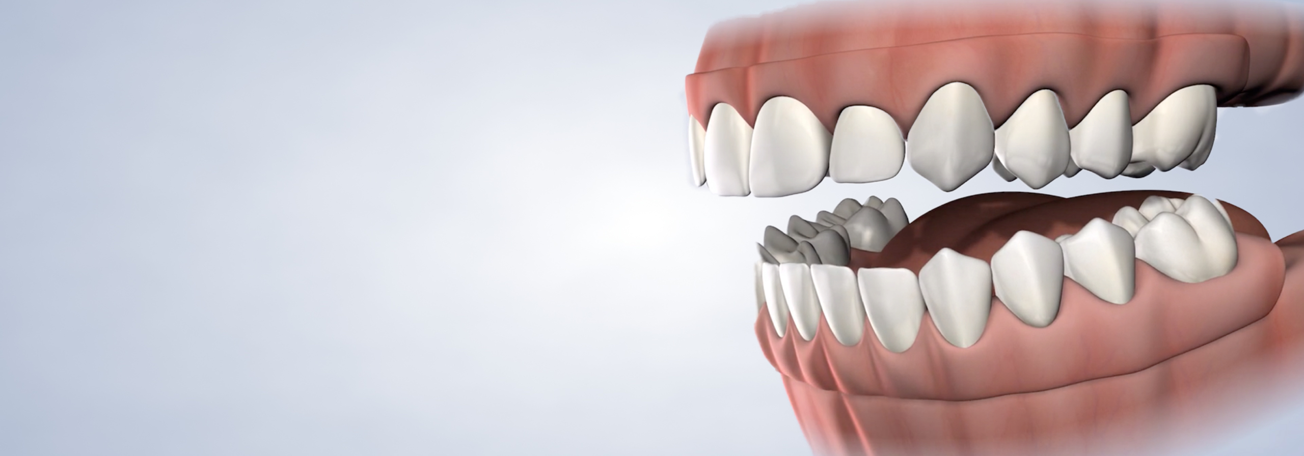 Pre prosthetic surgery procedure desktop