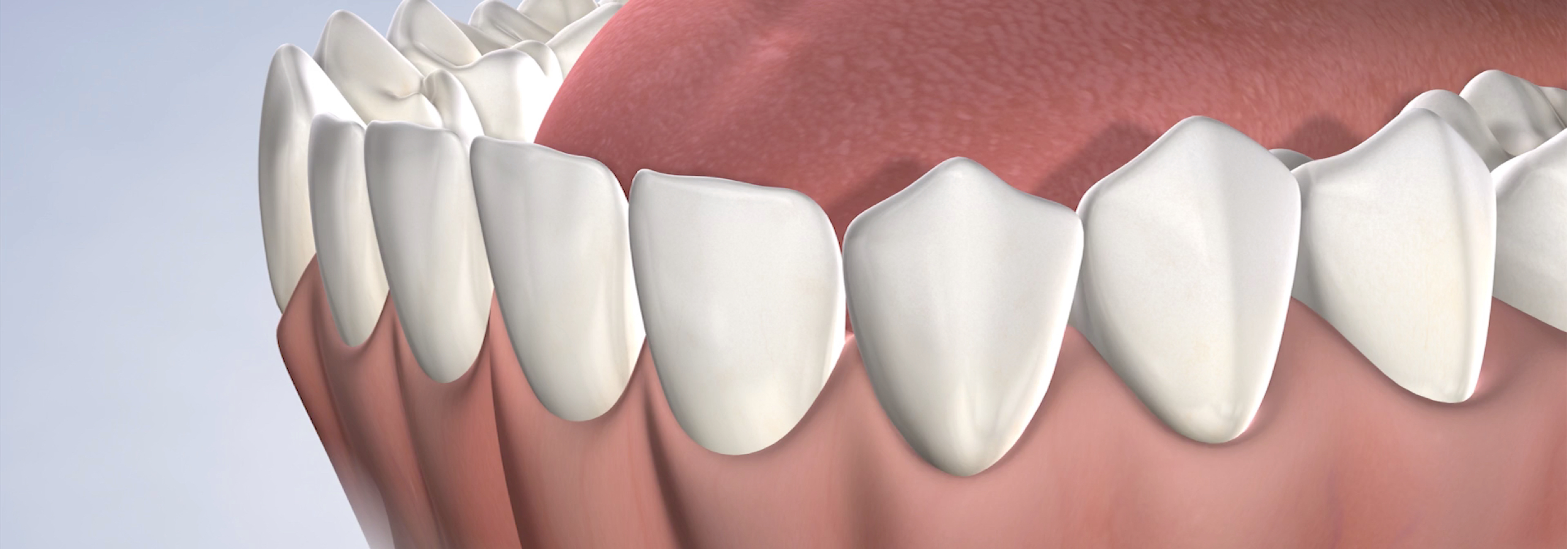 Procedure anesthesia video thumb