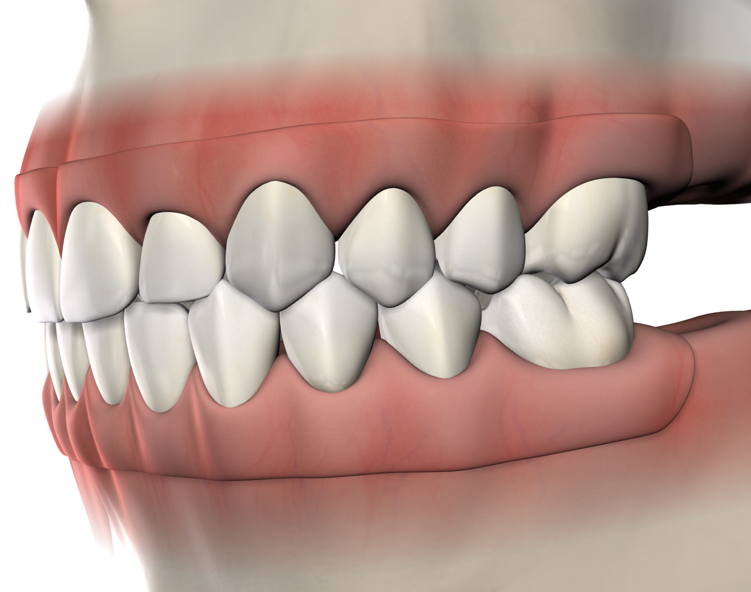 Isolated  pre prosthetic surgery