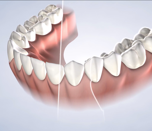 Dental cleanings in Dumas, Canyon, Amarillo, Farwell, and Dalhart, TX