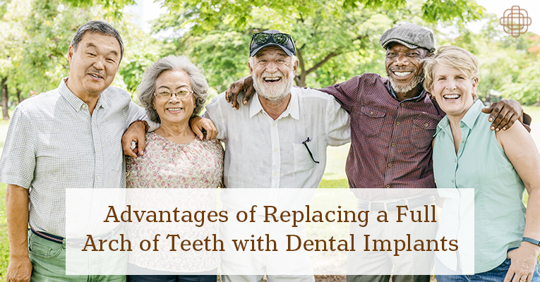 Advantages of FullArch Dental Implants