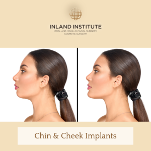 Gilbert Blog 1 300x300