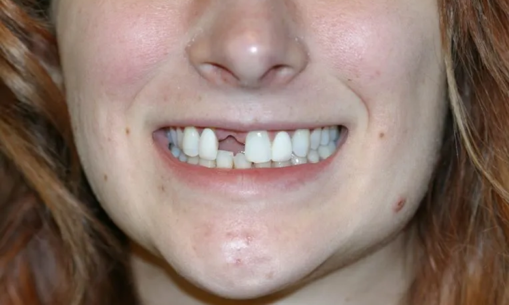 Case hope experience 1