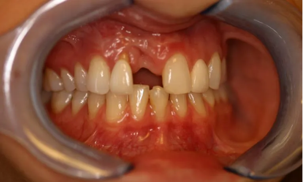 Case hope experience 10