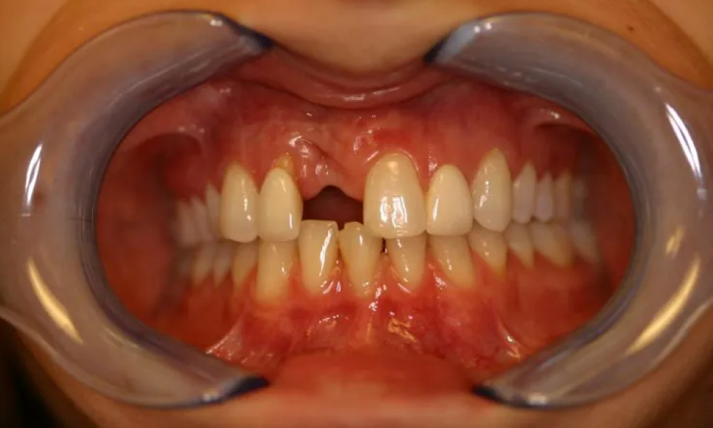 Case hope experience 2