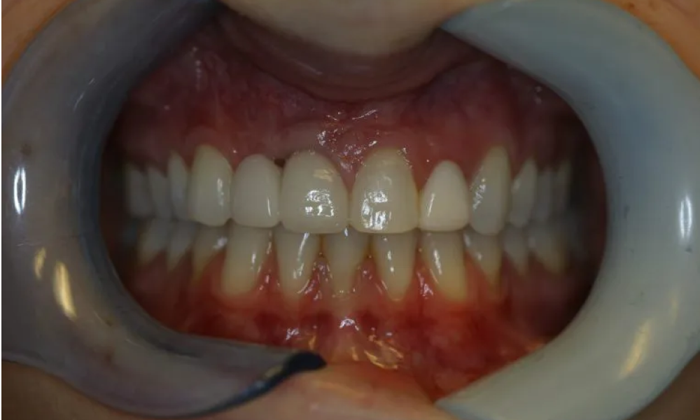 Case hope experience 3