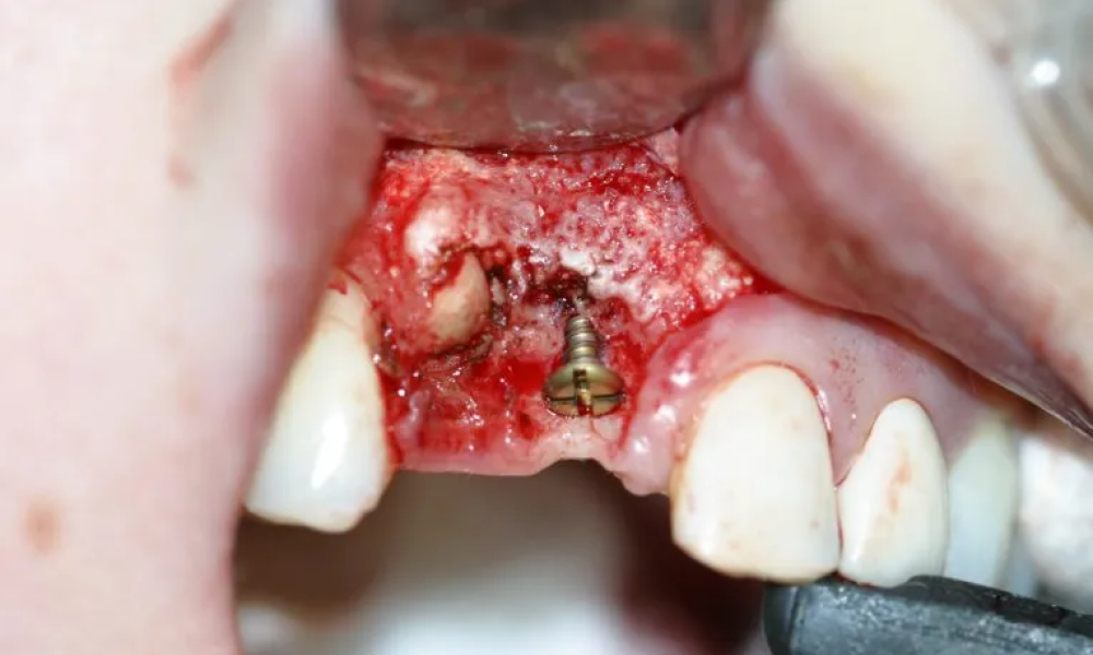 Case hope experience 5