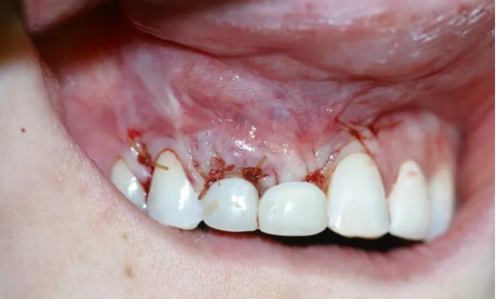 Case hope experience 6