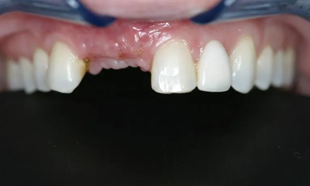 Case hope experience 7