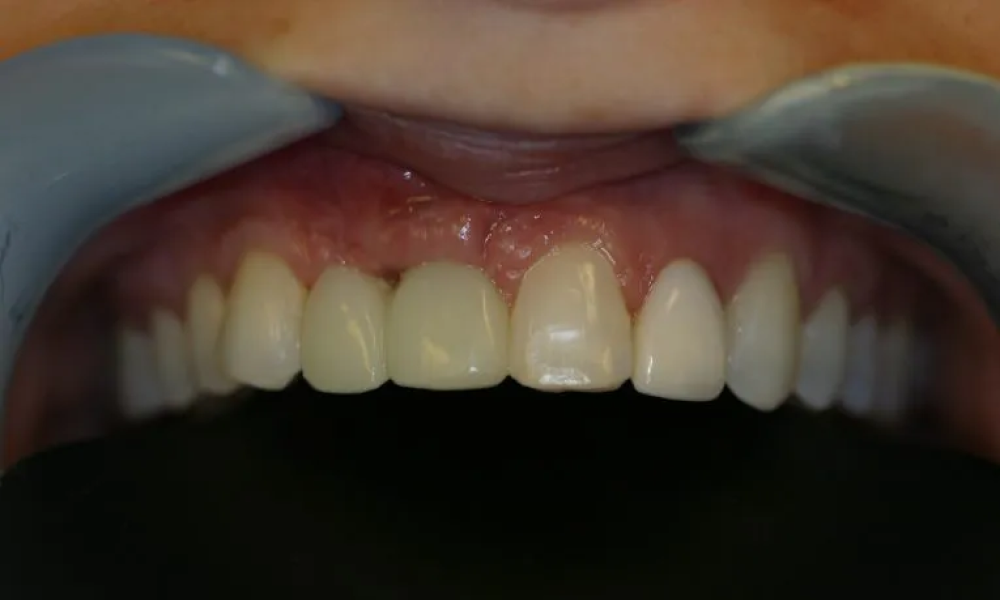 Case hope experience 8