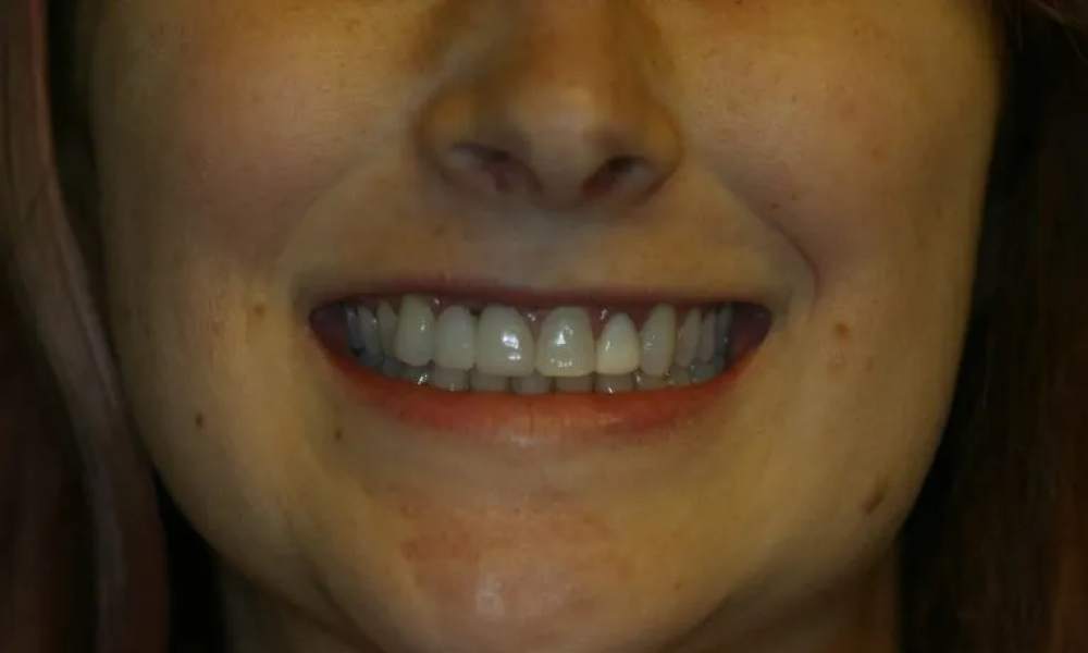 Case hope experience 9